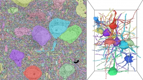 Preparing for exascale: Argonne’s Aurora supercomputer to drive brain map construction