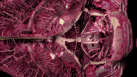 Reconstructed cerebrovascular network