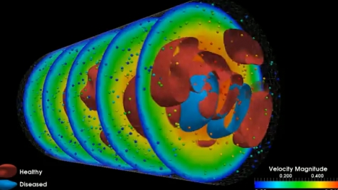 Modeling the elements of blood flow in the brain.