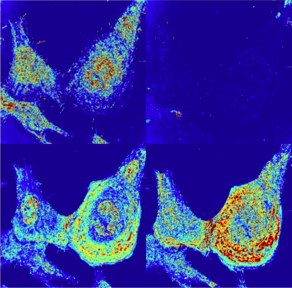 Alterations of the nanoscale structure of live HeLa cells after chemical fixation, as observed using partial wave spectroscopic (PWS) optical microscopy.  Chemical fixation appears to alter the cellular nanoscale structure in addition to terminating its macromolecular remodeling.  These changes could not be detected using traditional modes of optical microscopy, being far smaller than the diffraction limit of visible light.