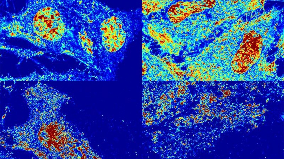 New Algorithms Shed Light on Molecules’ Structure and Motion in Cells