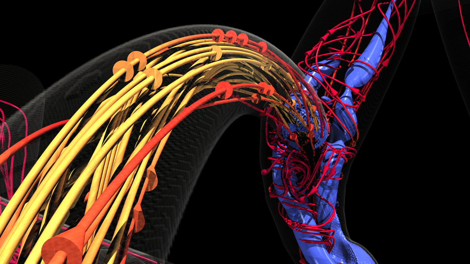 Extreme-Scale In-Situ Visualization and Analysis of Fluid-Structure-Interaction Simulations