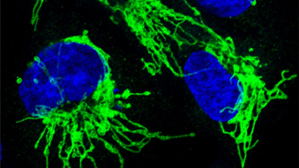 About a third of all human cancers are driven by mutations in RAS genes.